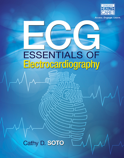 ECG Essentials of Electrocardiography, 1st Edition 9781285180984