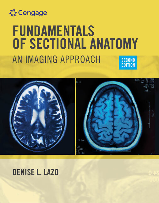 Sectional Anatomy for Imaging Professionals: 9780323414876